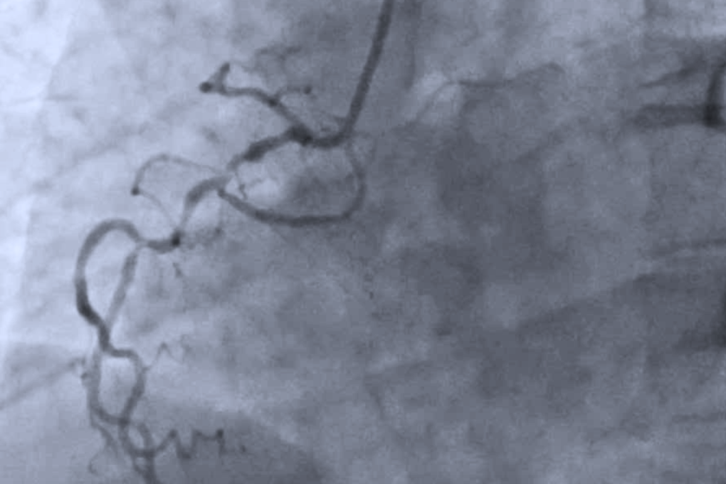 Tin tức 1
